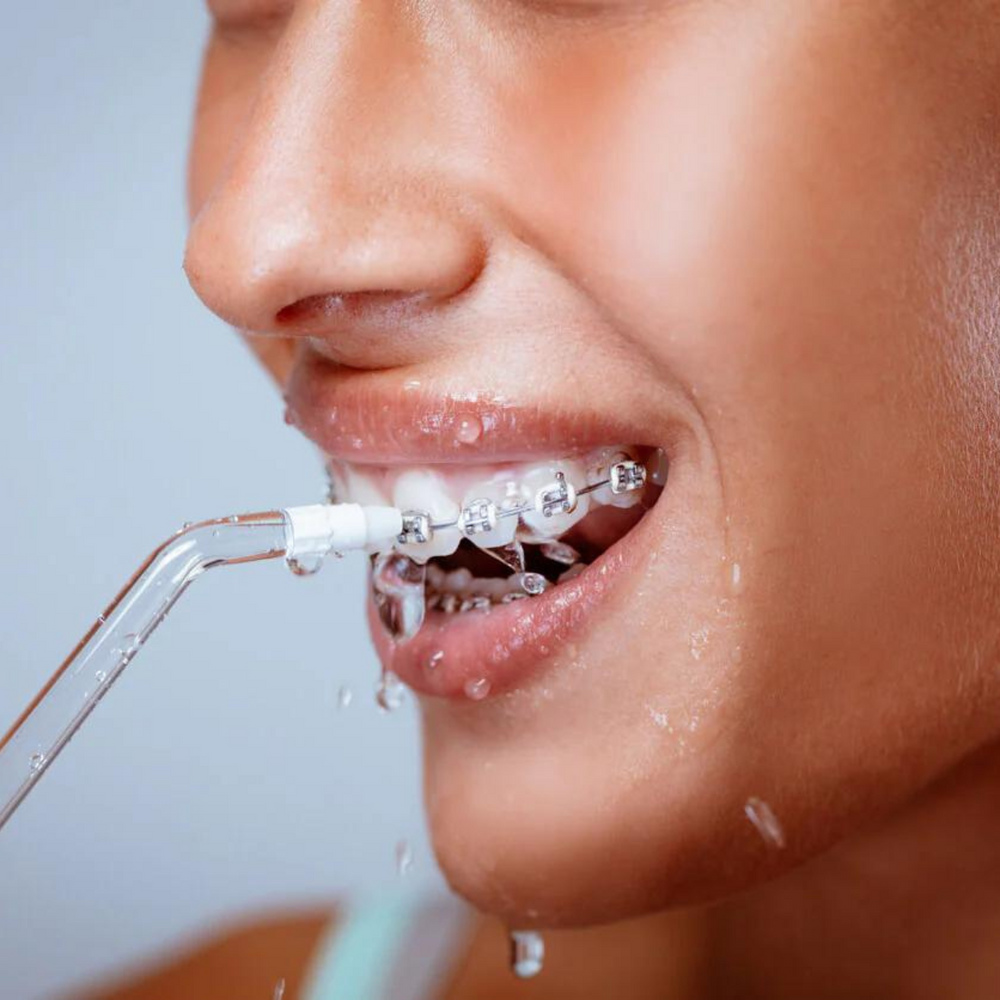 Zahnreiniger mit Wasserstrahl – Für saubere Zähne & gesundes Zahnfleisch