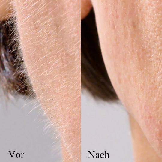 Gesichtshaarentferner Damen – Sanfte Rasur mit LED Präzision