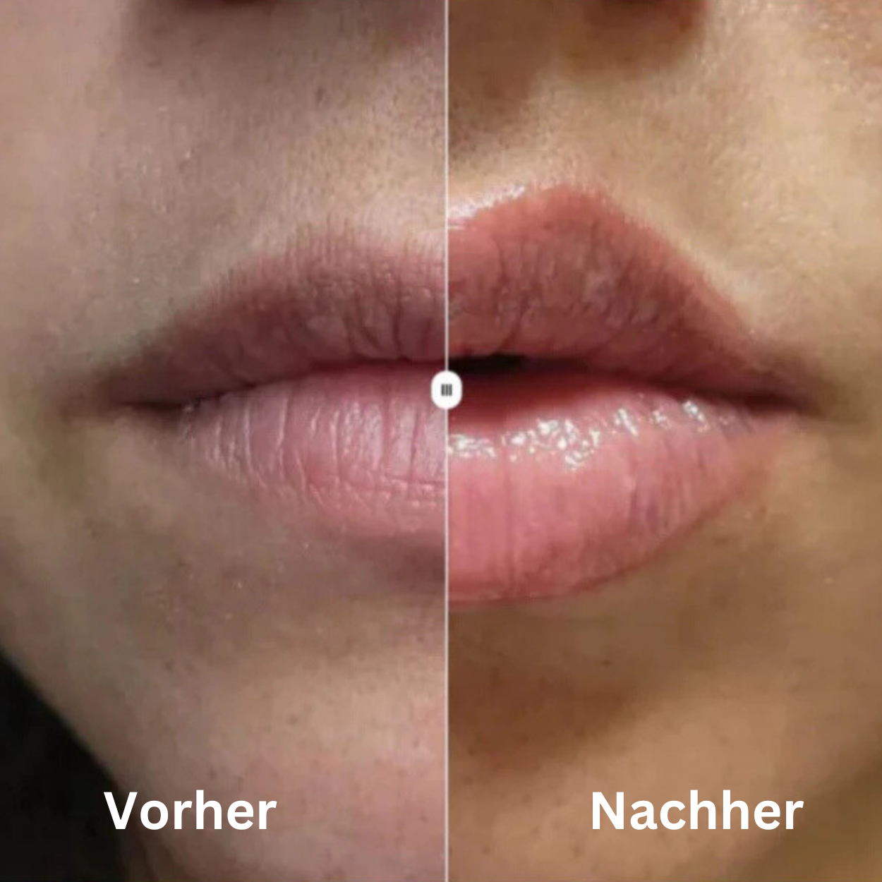 Lips Boost | Verleihen Sie Ihren Lippen einen verführerischen Glanz