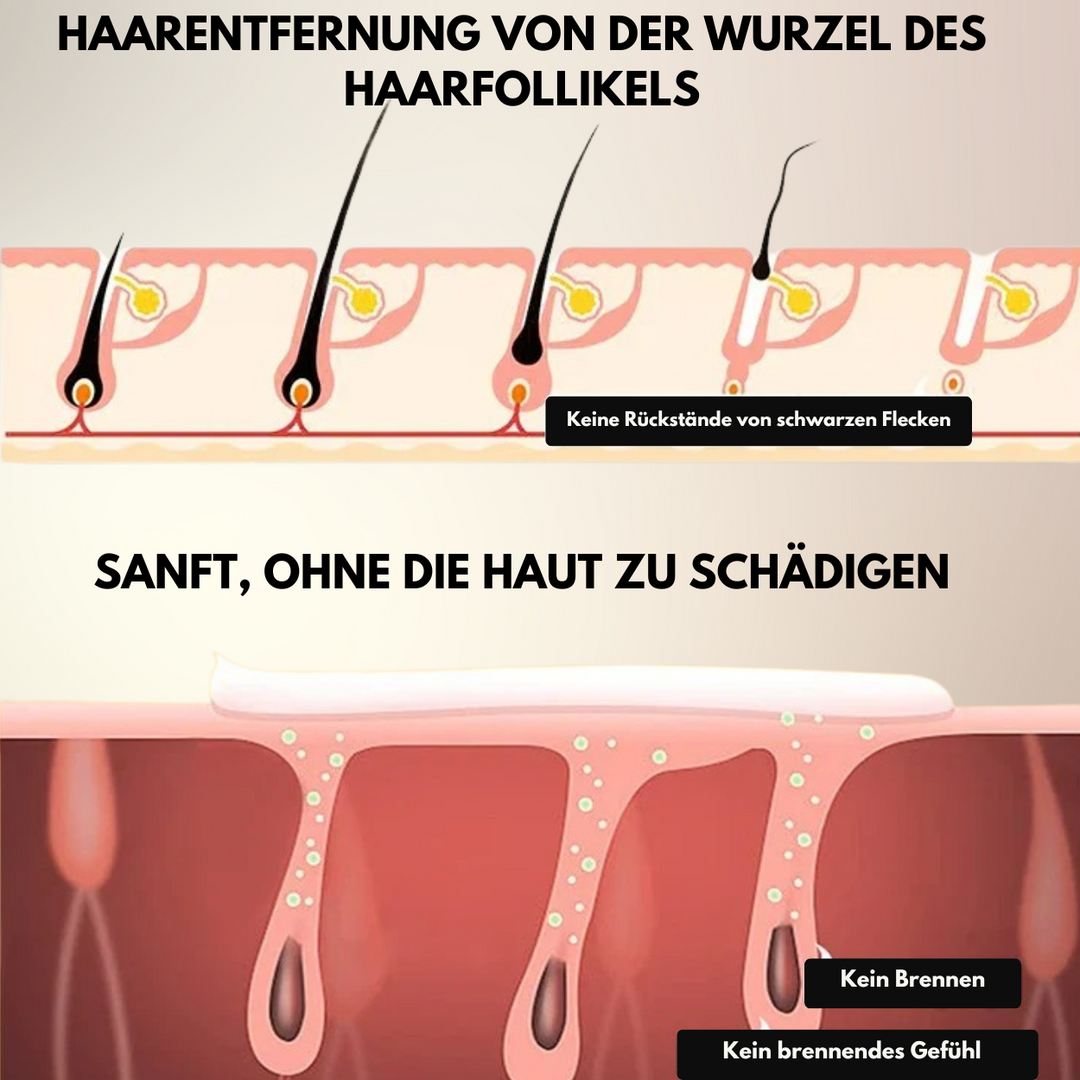 SoftRemove Creme – Schmerzfreie Haarentfernung in nur 60 Sekunden