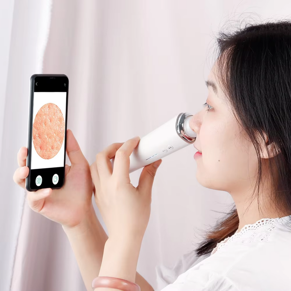 ClearView Porenreiniger – Mitesser gezielt entfernen mit HD-Kamera