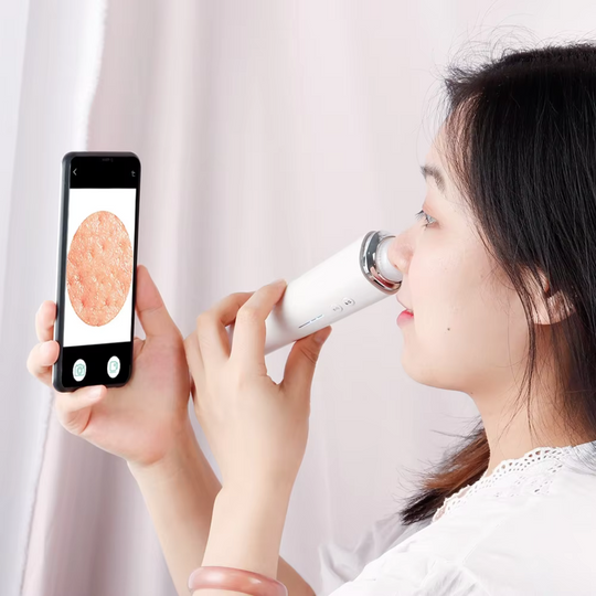 ClearView Porenreiniger – Mitesser gezielt entfernen mit HD-Kamera