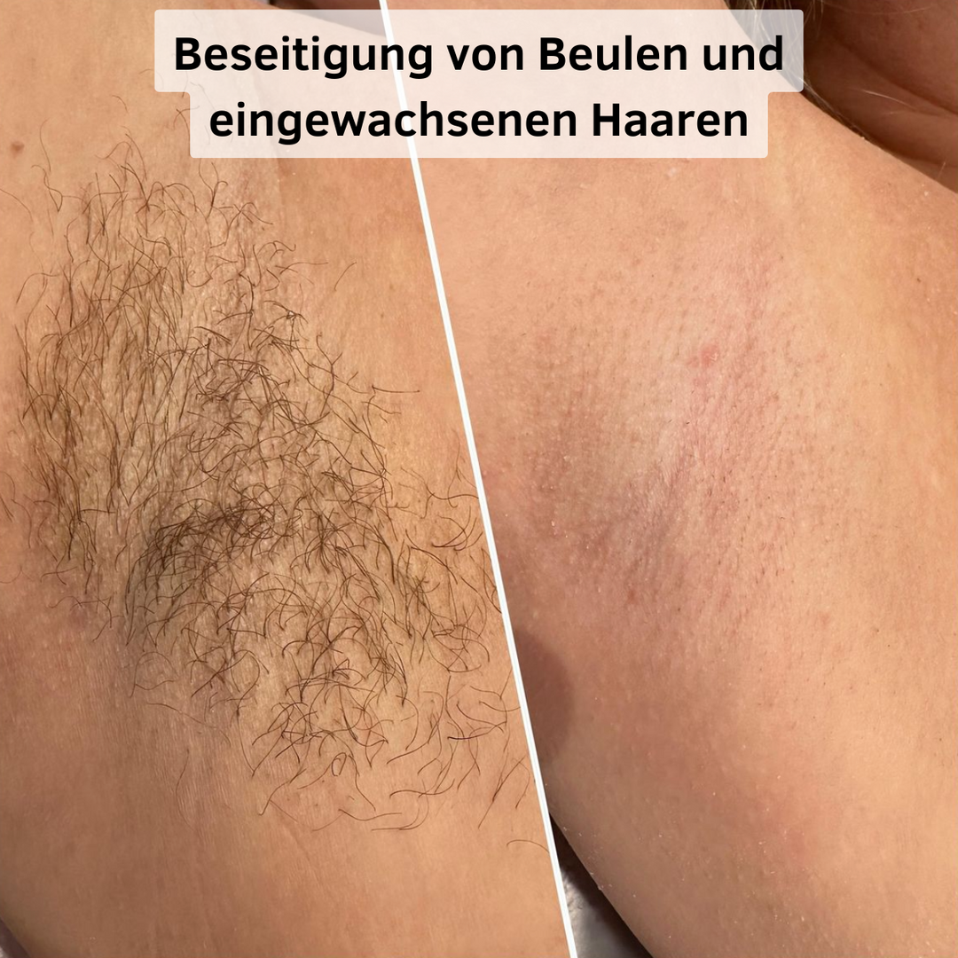 Beauty Glide Pro – Elektrischer Damenrasierer für glatte, gepflegte Haut