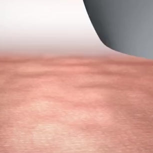 SilkFlash IPL – Dauerhafte Haarentfernung mit Lichttechnologie für Zuhause